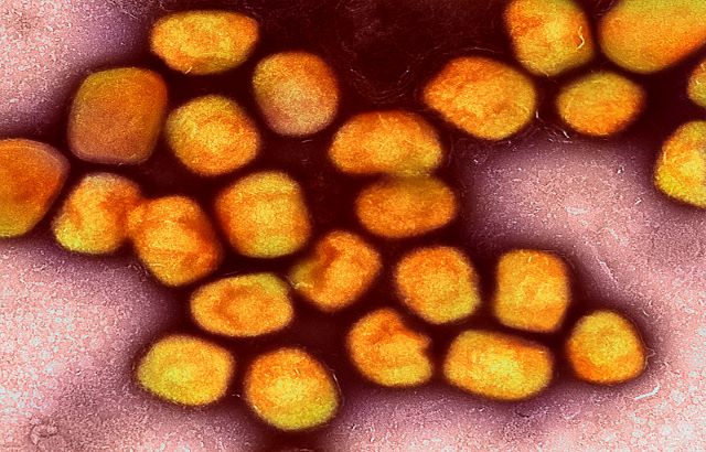 Colourised transmission electron micrograph of monkeypox virus particles (gold) cultivated and purified from cell culture. Image captured at the NIAID Integrated Research Facility (IRF) in Fort Detrick, Maryland. Credit: NIAID